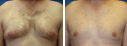 Before & After Photos